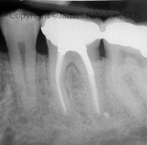 Molar